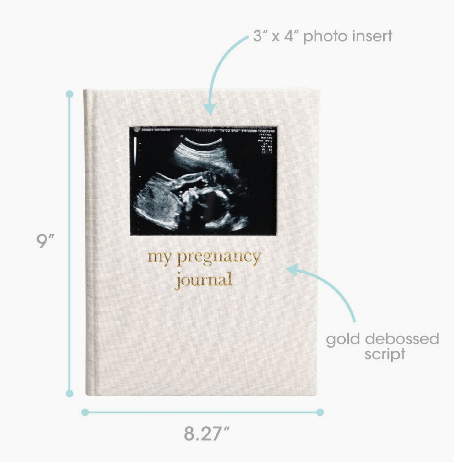 Pregnancy Journal